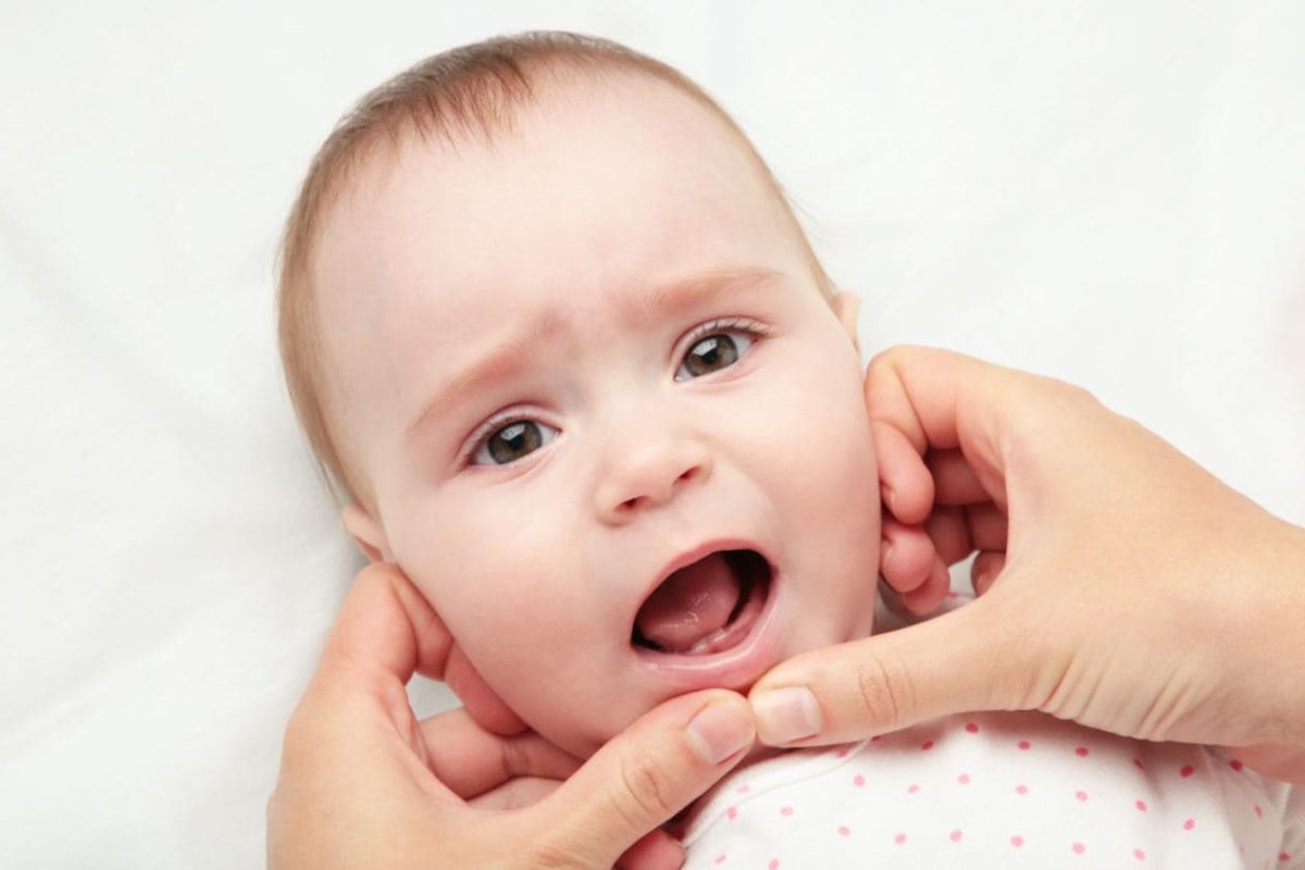 Lidah Putih Pada Bayi dan Cara Menanganinya